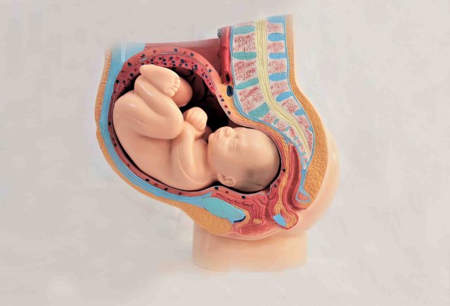 مانکن جایگیری جنین در رحم