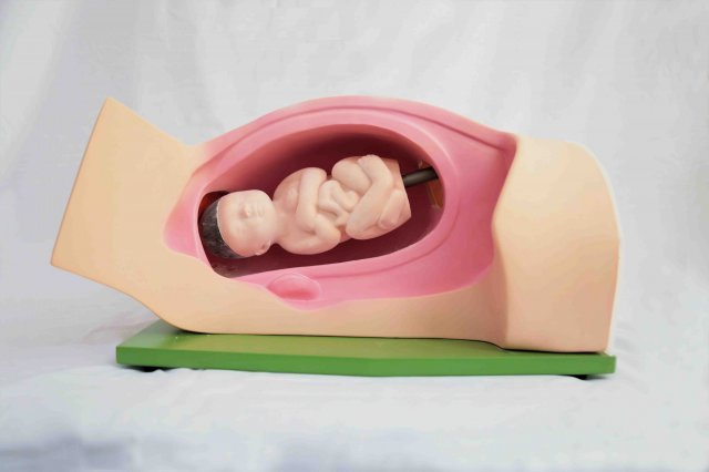 برش طولی جایگیری جنین در رحم